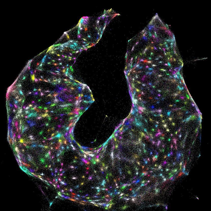 Используя специальный микроскоп для ДНК, ученые могут идентифицировать разные клетки (цветные точки) в образце, не зная, как выглядит образец. Источник: J. Weinstein et al. / Cell 2019